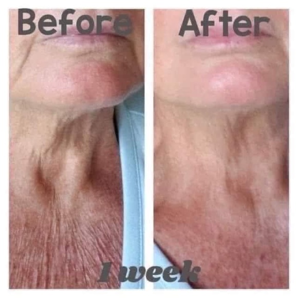 ageLOC® Dermatic Effects™ Body Contouring Lotion/Hibiscus Firming Cream - Picture 6 of 10